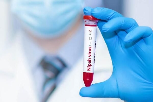 Virus Nipah: Indonesia Mengatakan Perlu Peningkatan Kewaspadaan, Namun Belum Ada Penutupan Perbatasan