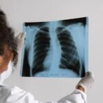 Seorang ahli onkologi dari Bengaluru membagikan 5 kebiasaan sehari-hari yang meningkatkan risiko kanker paru-paru: ‘Tidak ada tingkat merokok yang aman…’