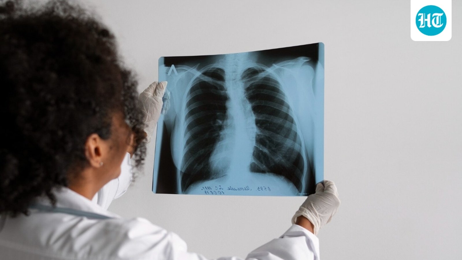 Seorang ahli onkologi dari Bengaluru membagikan 5 kebiasaan sehari-hari yang meningkatkan risiko kanker paru-paru: ‘Tidak ada tingkat merokok yang aman…’